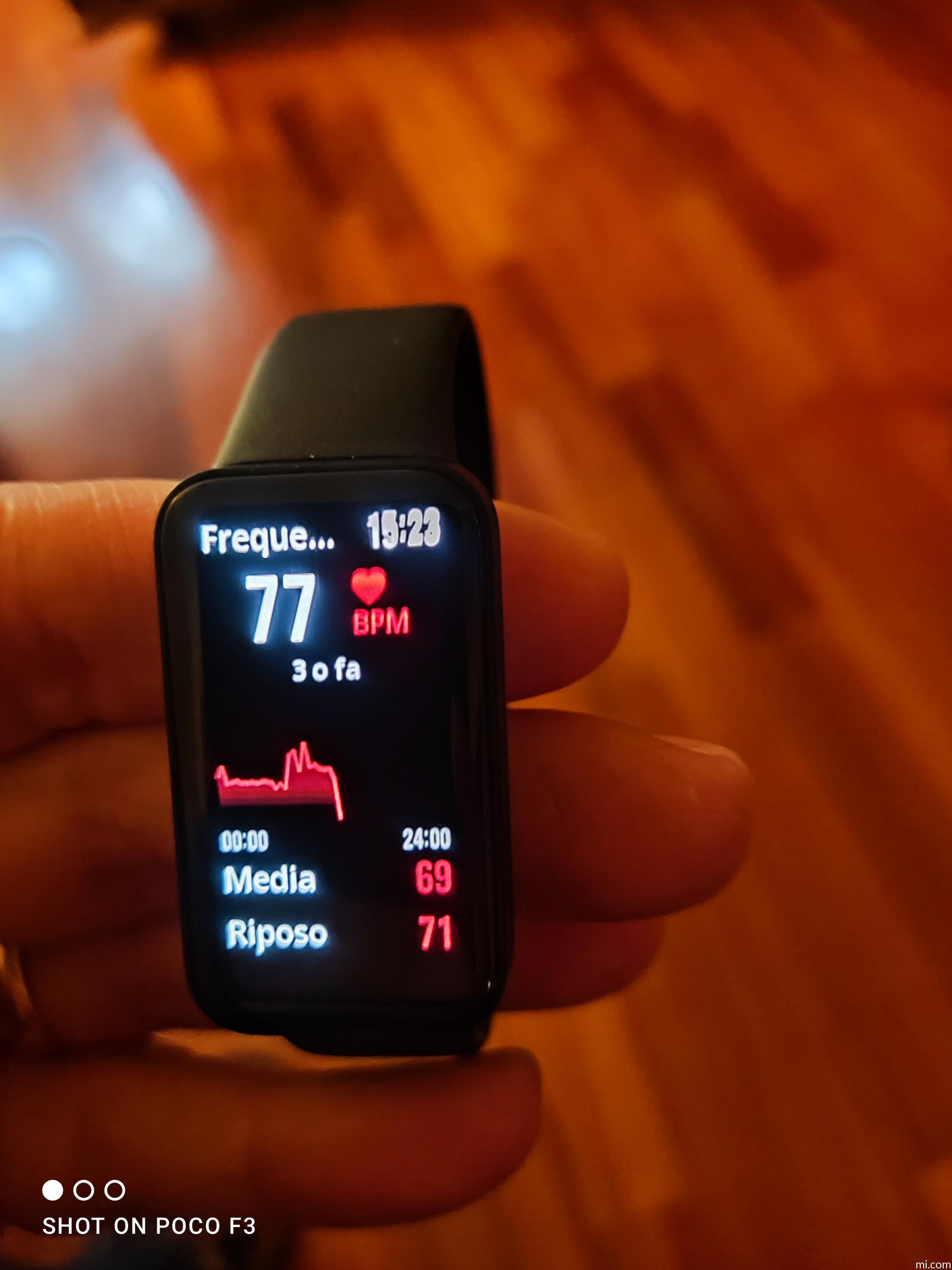 Redmi Smart Band Pro | Xiaomi Italia